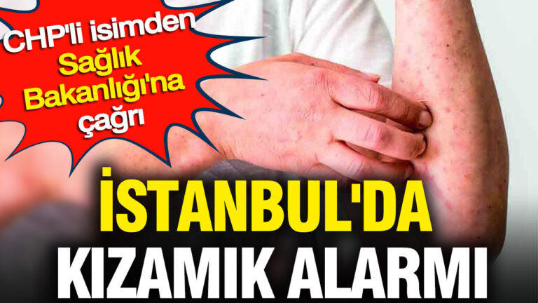 istanbulda-kizamik-alarmi-chpli-isimden-saglik-bakanligina-cagri-IdP2NmOx
